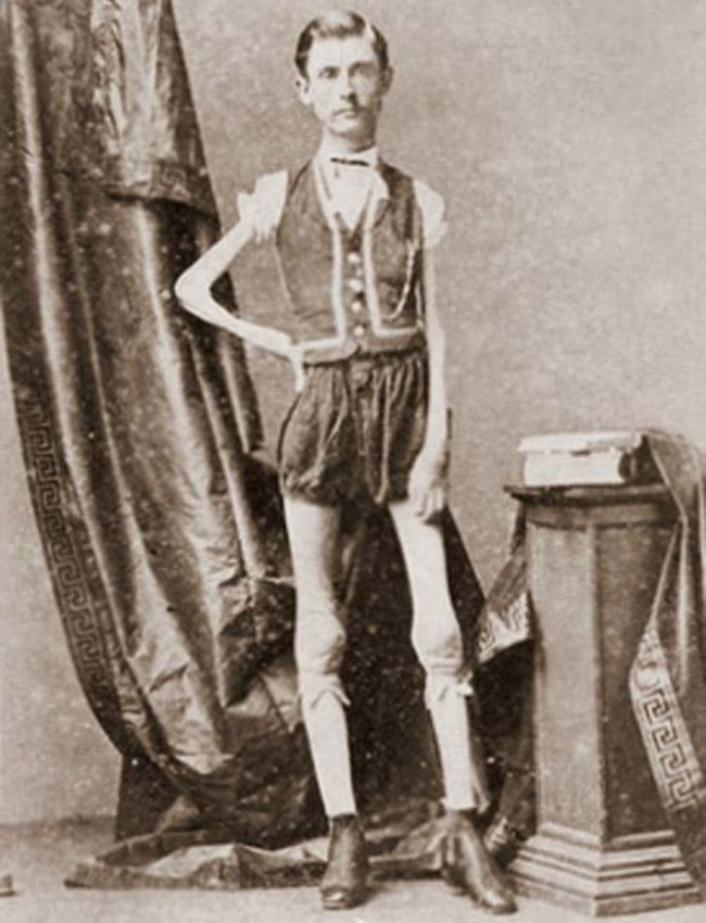 Isaac Sprague - bộ xương di động