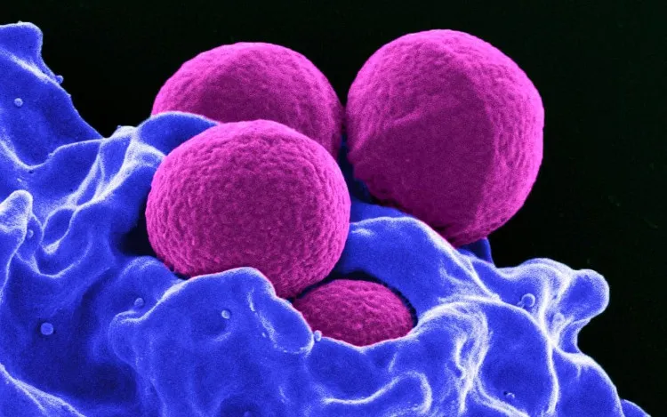 Vi khuẩn MRSA là mối đe dọa lớn với con người.