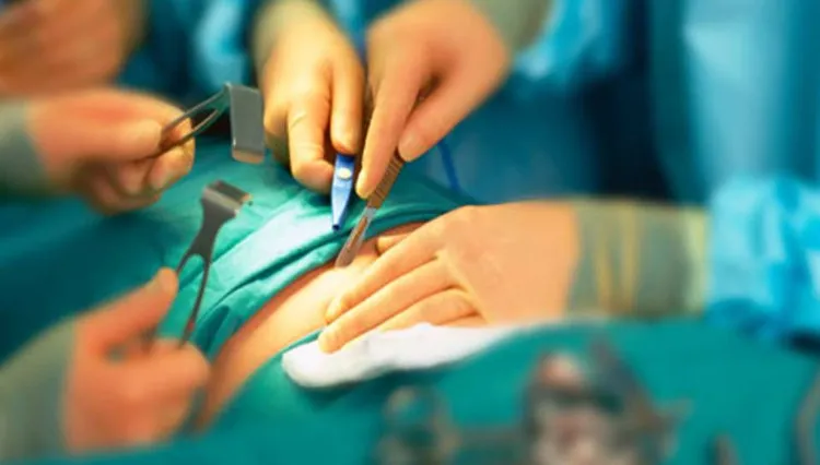 Sau 5 năm, nhóm được phẫu thuật thắt dạ dày giảm trung bình 12,2% trọng lượng cơ thể.