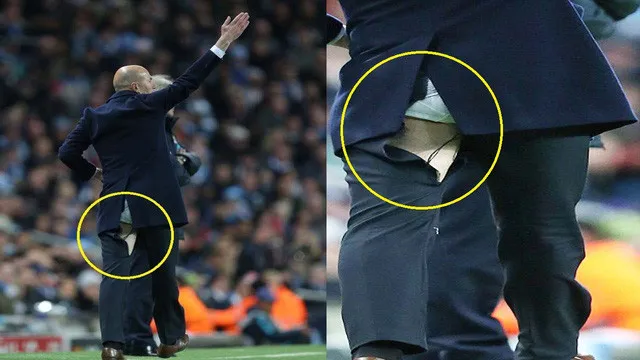Zinedine Zidane bị toạc đũng quần trong một trận đấu giao hữu giữa Real Madrid và Manchester City.