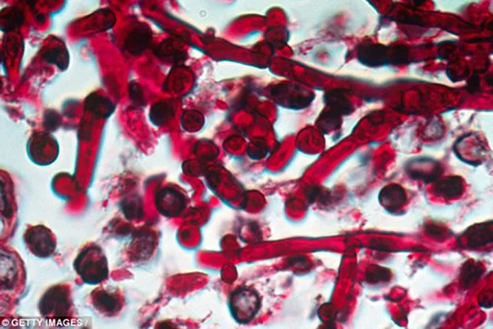 Được gọi là Candida auris, chủng nấm này kháng thuốc rất mạnh và có khả năng gây ra nhiễm trùng máu dẫn đến tử vong.