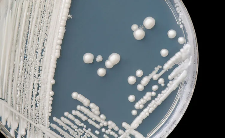 Candida auris, một chủng nấm gây nhiễm trùng chết người mới.