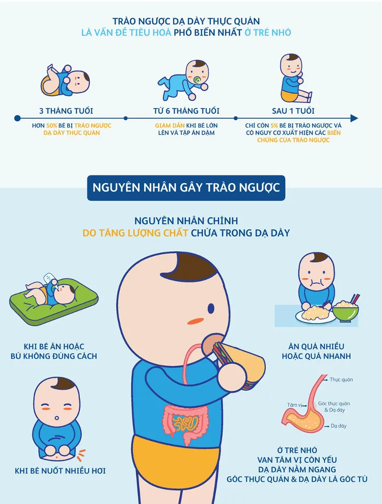 Nguyên nhân chính dẫn đến việc trào ngược dạ dày thực quản ở trẻ là do tăng lượng chất chứa trong dạ dày.