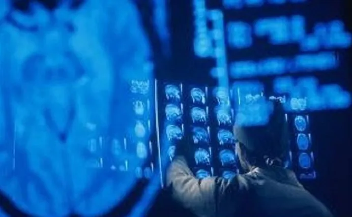 Các bệnh nhân sẽ được theo dõi bằng máy MRI trong nhiều tháng.