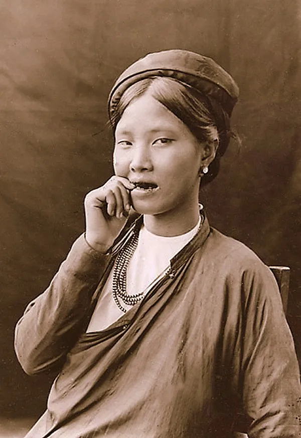 Nhuộm răng đen